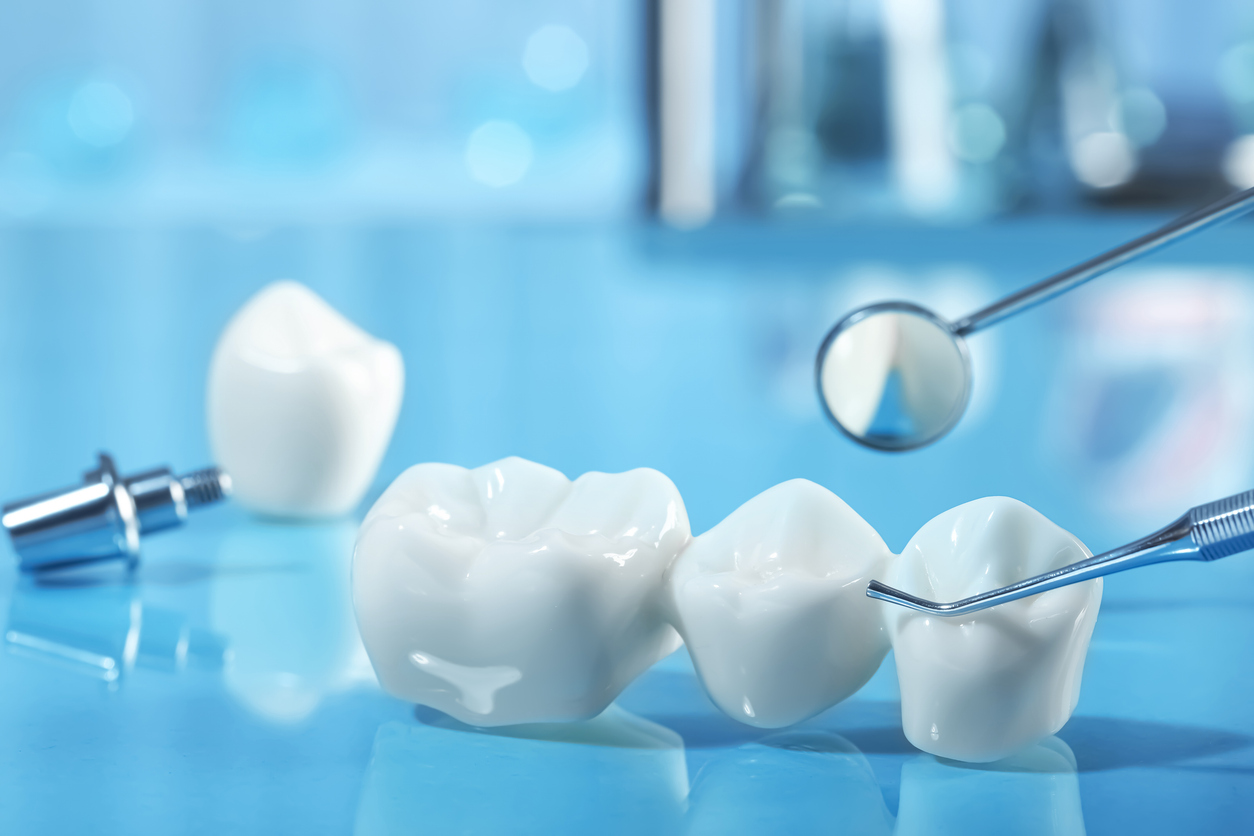 Featured image for Guide to Tooth Replacement Options